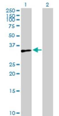 Western Blot: ZNF75A Antibody [H00007627-B01P]