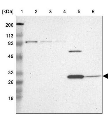 Western Blot: ZNF75A Antibody [NBP1-82020]