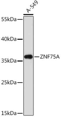 Western Blot: ZNF75A AntibodyAzide and BSA Free [NBP3-15509]