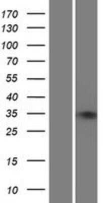 Western Blot: ZNF75A Overexpression Lysate [NBP2-05283]