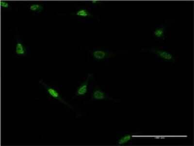 Immunocytochemistry/ Immunofluorescence: ZNF76 Antibody (3D4) [H00007629-M06]