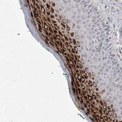 Immunohistochemistry-Paraffin: ZNF76 Antibody [NBP1-85323]