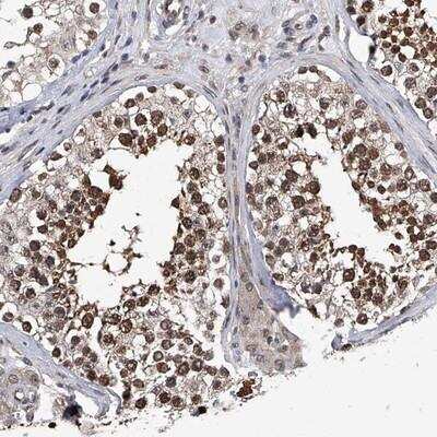 Immunohistochemistry-Paraffin: ZNF76 Antibody [NBP1-85324]