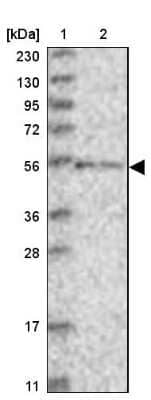 Western Blot: ZNF76 Antibody [NBP1-85323]