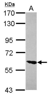 Western Blot: ZNF76 Antibody [NBP2-21048]