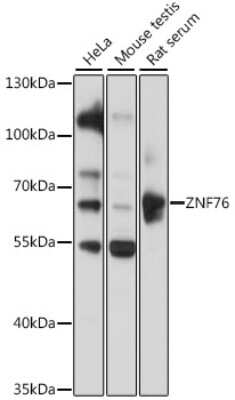 Western Blot: ZNF76 AntibodyAzide and BSA Free [NBP3-04364]