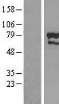 Western Blot: ZNF76 Overexpression Lysate [NBL1-18244]