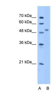 Western Blot: ZNF763 Antibody [NBP1-79358]