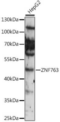 Western Blot: ZNF763 AntibodyAzide and BSA Free [NBP2-94730]