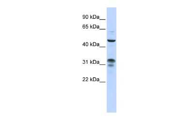 Western Blot: ZNF765 Antibody [NBP2-84364]