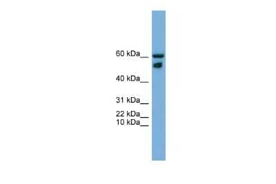 Western Blot: ZNF765 Antibody [NBP2-84365]