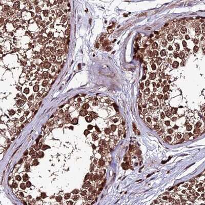 Immunohistochemistry-Paraffin: ZNF766 Antibody [NBP1-92643]