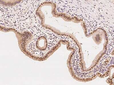 Immunohistochemistry-Paraffin: ZNF766 Antibody [NBP2-98465]