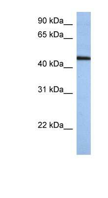 Western Blot: ZNF766 Antibody [NBP1-79354]