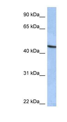 Western Blot: ZNF766 Antibody [NBP1-79355]