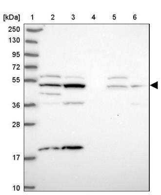 Western Blot: ZNF766 Antibody [NBP1-92643]