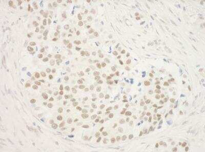 Immunohistochemistry: ZNF768 Antibody [NBP1-78220]