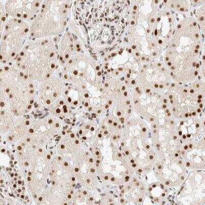 Immunohistochemistry: ZNF768 Antibody [NBP1-83586]