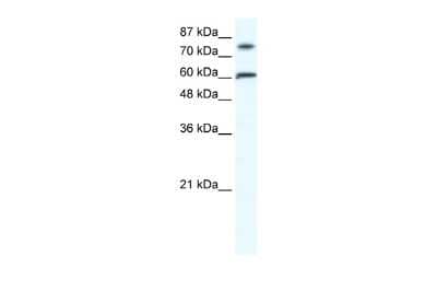 Western Blot: ZNF768 Antibody [NBP2-88734]