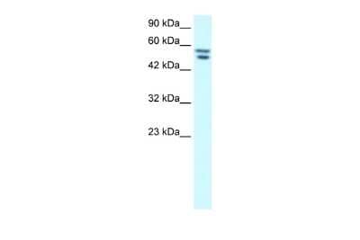 Western Blot: ZNF768 Antibody [NBP2-88735]