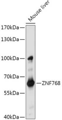 Western Blot: ZNF768 AntibodyAzide and BSA Free [NBP2-94393]