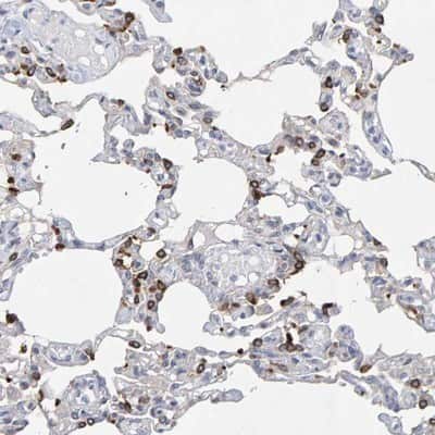 Immunohistochemistry-Paraffin: ZNF77 Antibody [NBP1-80873]