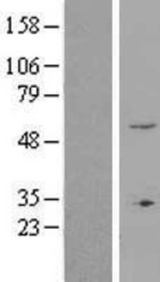 Western Blot: ZNF77 Overexpression Lysate [NBL1-18247]