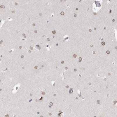 Immunohistochemistry-Paraffin: ZNF770 Antibody [NBP1-82172]