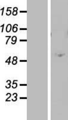 Western Blot: ZNF770 Overexpression Lysate [NBP2-07379]