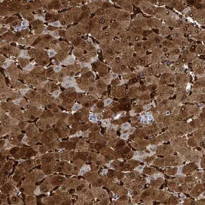 Immunohistochemistry-Paraffin: ZNF771 Antibody [NBP2-13595]