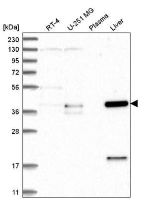 Western Blot: ZNF771 Antibody [NBP2-55199]