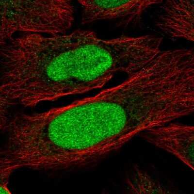 Immunocytochemistry/ Immunofluorescence: ZNF776 Antibody [NBP2-57093]