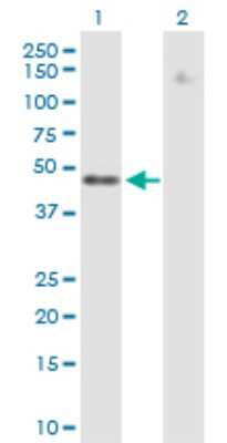 Western Blot: ZNF776 Antibody [H00284309-B01P]