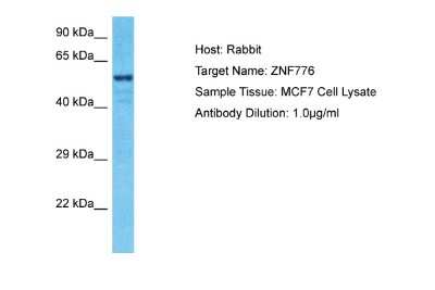 Western Blot: ZNF776 Antibody [NBP2-88738]