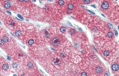 Immunohistochemistry: ZNF777 Antibody [NBP2-88740]