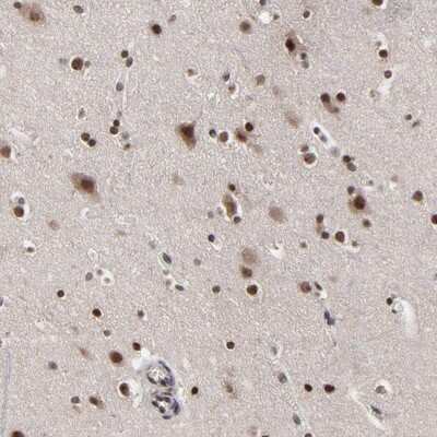 Immunohistochemistry-Paraffin: ZNF777 Antibody [NBP1-82918]