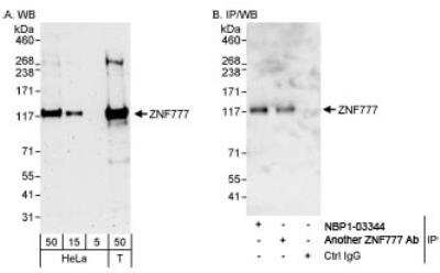 Western Blot: ZNF777 Antibody [NBP1-03344]