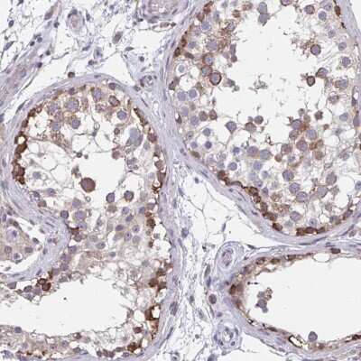 Immunohistochemistry-Paraffin: ZNF778 Antibody [NBP2-33817]