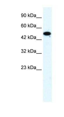 Western Blot: ZNF778 Antibody [NBP1-80195]