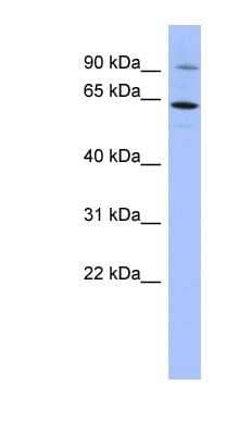 Western Blot: ZNF778 Antibody [NBP1-80436]