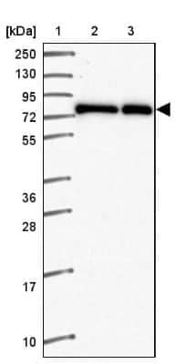 Western Blot: ZNF778 Antibody [NBP2-33637]