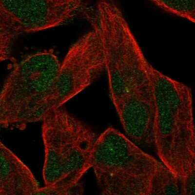 Immunocytochemistry/ Immunofluorescence: ZNF780B Antibody [NBP1-80588]