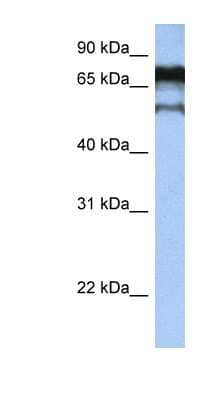 Western Blot: ZNF780B Antibody [NBP1-79348]