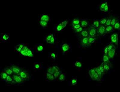 Immunocytochemistry/ Immunofluorescence: ZNF782 Antibody [NBP3-06582]