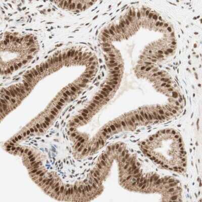 Immunohistochemistry-Paraffin: ZNF782 Antibody [NBP1-82211]
