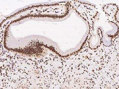Immunohistochemistry-Paraffin: ZNF782 Antibody [NBP3-06582]