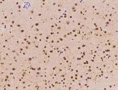 Immunohistochemistry-Paraffin: ZNF782 Antibody [NBP3-06582]