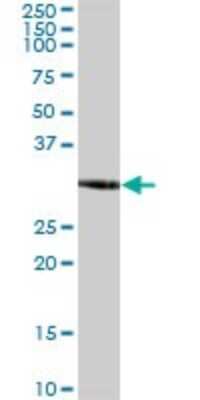 Western Blot: ZNF783 Antibody [H00155060-B01P]