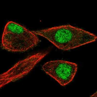 Immunocytochemistry/ Immunofluorescence: ZNF784 Antibody [NBP2-31791]