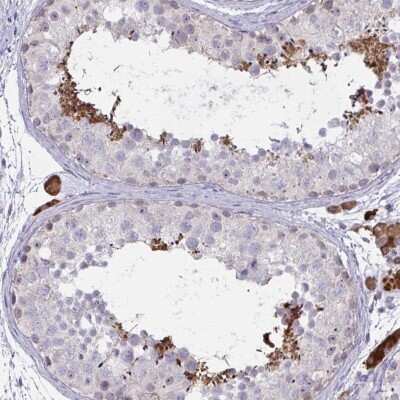 Immunohistochemistry-Paraffin: ZNF784 Antibody [NBP2-31791]